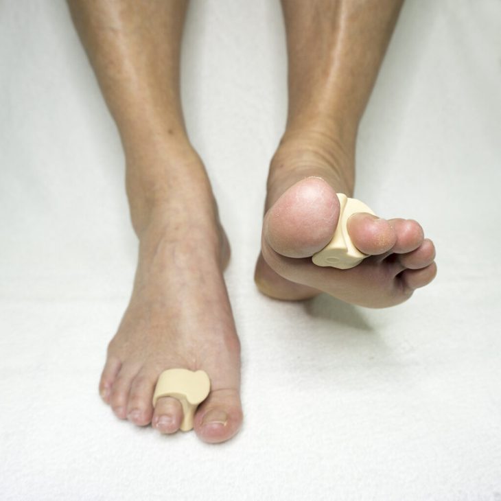 pedisil-hallux-valgus-teencorrect-pedicure-groothandel-pedimed